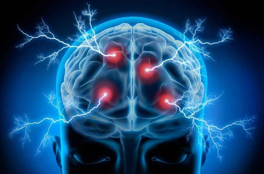 Epilepsias