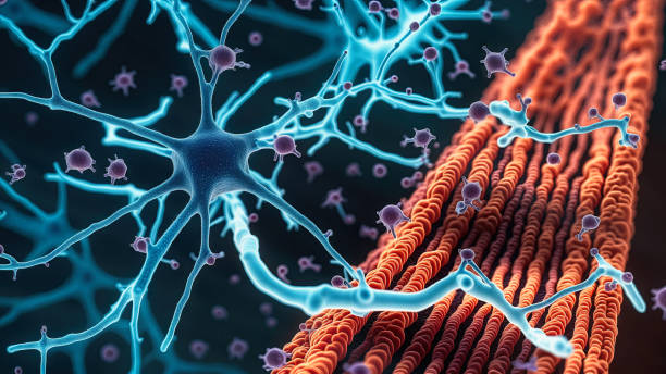 Neuropatias e transtornos neuromusculares